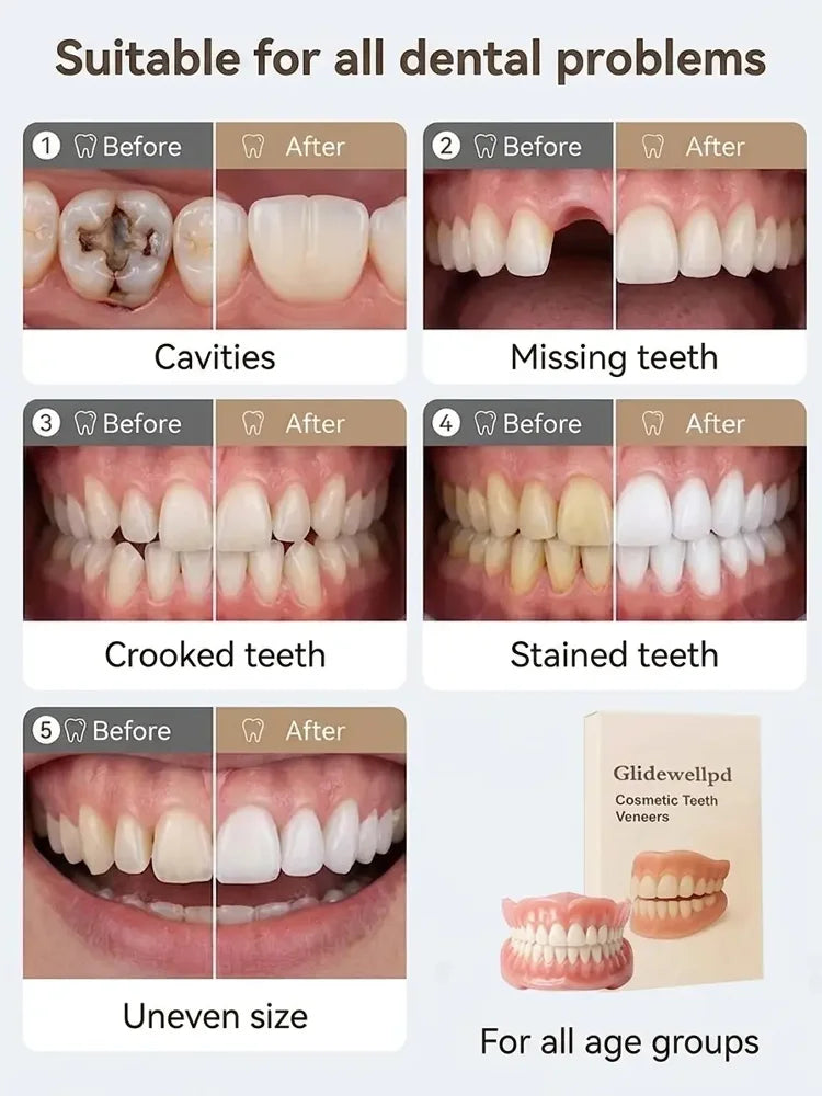 Epic Upgrade Premium Full Cover Dentures