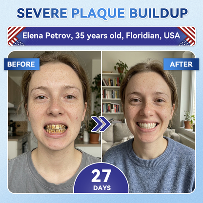Your Smile~ SpringCherry® 🦷 Tideglusib Fast‑Dissolving Tooth & Gum Repair Oral Strips ✨ (𝟓-𝐢𝐧-𝟏 💎 𝐑𝐞𝐛𝐮𝐢𝐥𝐝 𝐄𝐧𝐚𝐦𝐞𝐥 & 𝐃𝐞𝐧𝐭𝐢𝐧 • 𝐒𝐭𝐫𝐞𝐧𝐠𝐭𝐡𝐞𝐧 𝐆𝐮𝐦𝐬 • 𝐄𝐫𝐚𝐝𝐢𝐜𝐚𝐭𝐞 𝐓𝐚𝐫𝐭𝐚𝐫 & 𝐎𝐝𝐨𝐫 • 𝐖𝐡𝐢𝐭𝐞𝐧𝐢𝐧𝐠 • 𝐒𝐭𝐨𝐩 𝐓𝐨𝐨𝐭𝐡 𝐒𝐞𝐧𝐬𝐢𝐭𝐢𝐯𝐢𝐭𝐲)