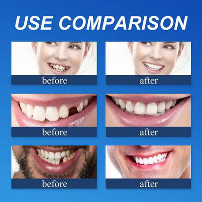 Ends Today ⏰ 70% OFF Exclusive Offer Pawoim™ Advanced Full Denture System 🦷 Pro-Level Suction Technology | Natural Aesthetic Fit | Daily Comfort Wear
