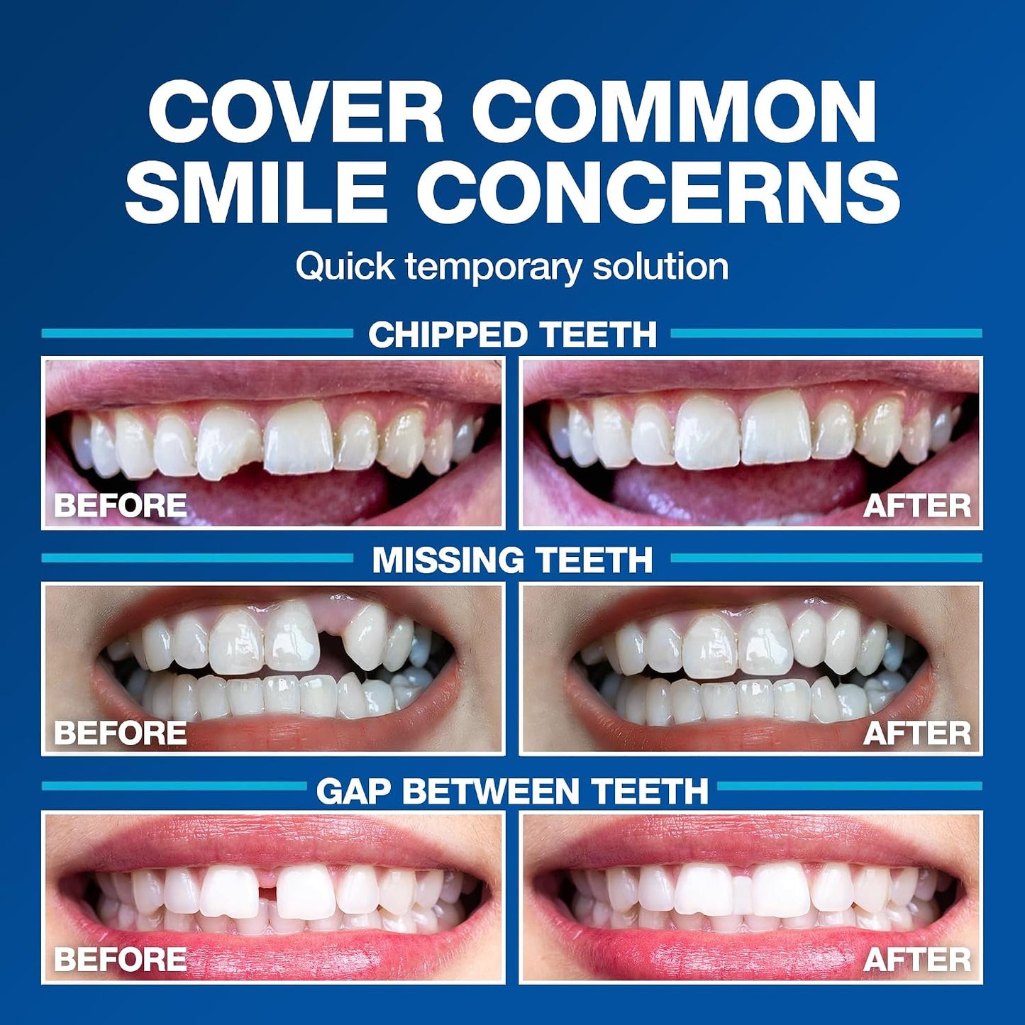 Imako Tooth Tinted Plastic - Natural Color - Temporary Tooth - Made in USA