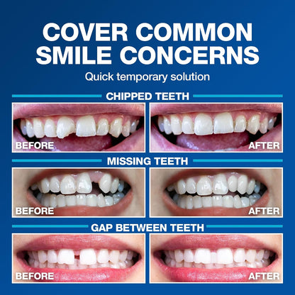 Imako Tooth Tinted Plastic - Natural Color - Temporary Tooth - Made in USA