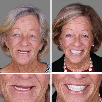 Ends Today: 70% OFF!  🏆2026 Bestselling Product🦷 Fit for a Fresh Smile, Say Goodbye to Wearing Discomfort!🌎