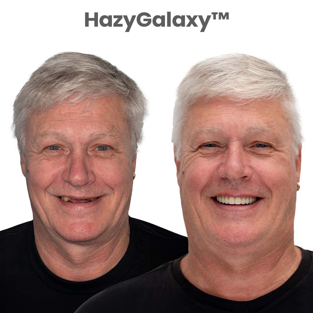 HazyGalaxy™ Custom-Fit Dentures ⏰ ENDS TODAY   70% OFF | Smile with Confidence