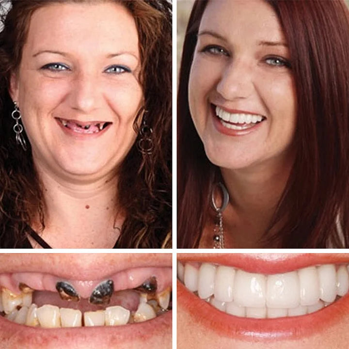 🦷𝐌𝐞𝐝𝐢𝐜𝐚𝐥-𝐆𝐫𝐚𝐝𝐞 𝐃𝐞𝐧𝐭𝐮𝐫𝐞𝐬 | 𝐍𝐚𝐭𝐮𝐫𝐚𝐥 𝐂𝐨𝐦𝐟𝐨𝐫𝐭 𝐅𝐢𝐭 𝐟𝐨𝐫 𝐈𝐧𝐬𝐭𝐚𝐧𝐭 𝐂𝐨𝐧𝐟𝐢𝐝𝐞𝐧𝐭 𝐒𝐦𝐢𝐥𝐞