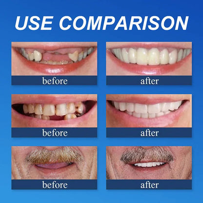 Ends Today: 70% OFF! ⏰DarkFairy™ Medical Full Denture with Strong Suctiond🦷